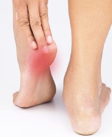 Heel Pain