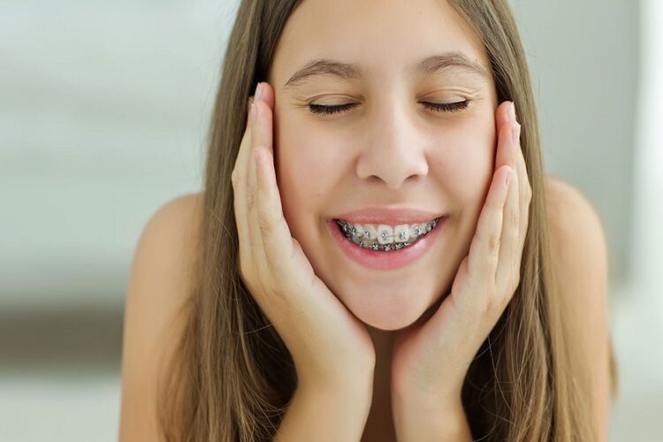 Teeth Aligners Essentials