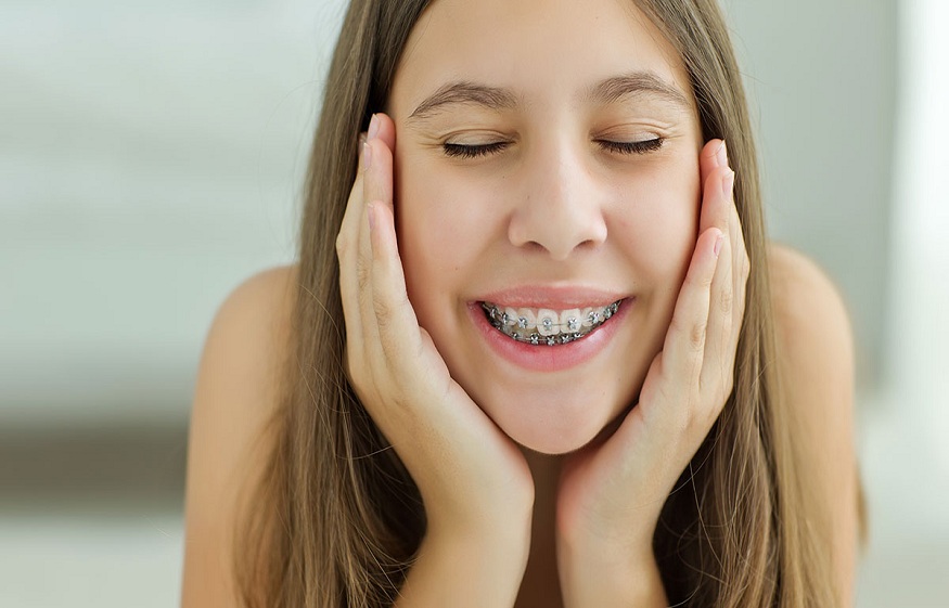 Teeth Aligners Essentials: Here’s a list of products available
