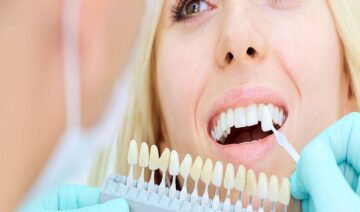 Cosmetic dentistry