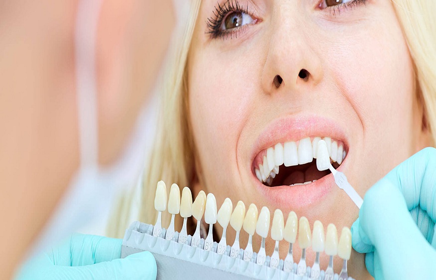 Cosmetic dentistry – All you need to know
