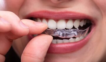 Explanation of Bruxism