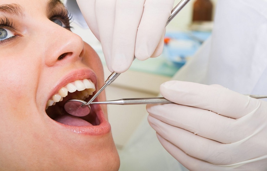 Everything You Should Know About Root Canal