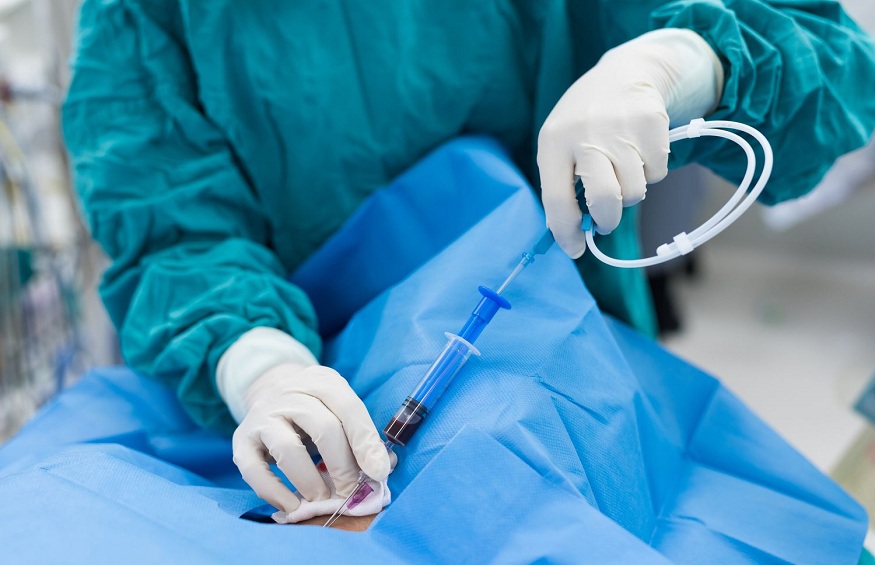 Vascular Surgery vs Endovascular Surgery: Which is Right for You?