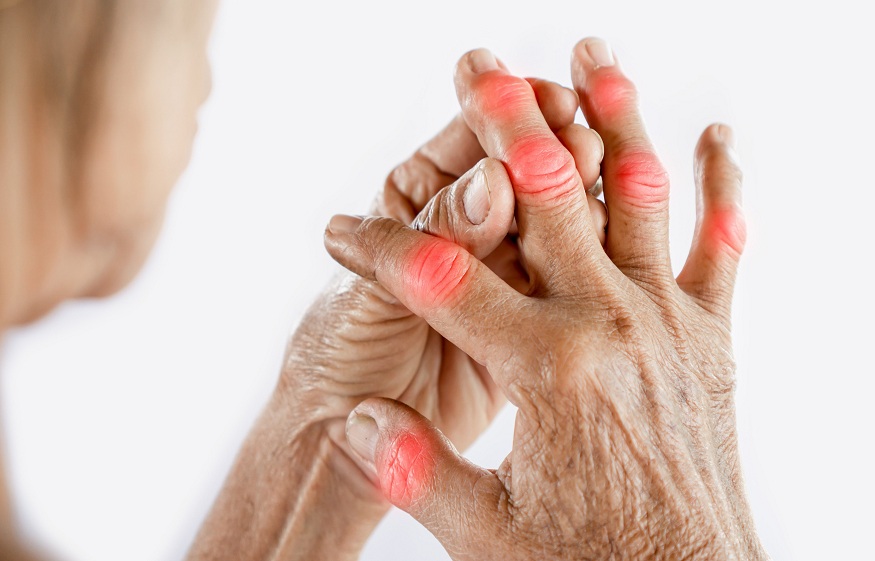 Arthritis Option